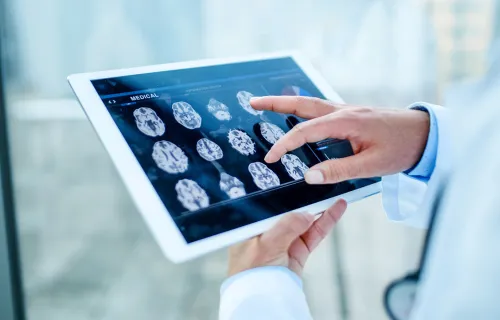 male clinician’s hands reviewing a brain scan on a tablet device